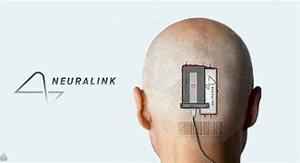 Компания Маска Neuralink впервые вживила чип в мозг человека