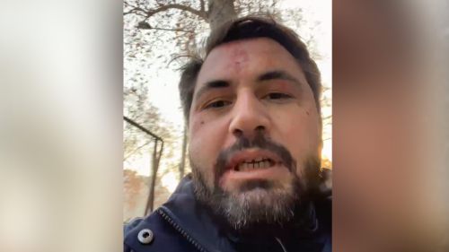 В Тбилиси избит гражданин, с которым в январе подрались депутаты «Мечты»