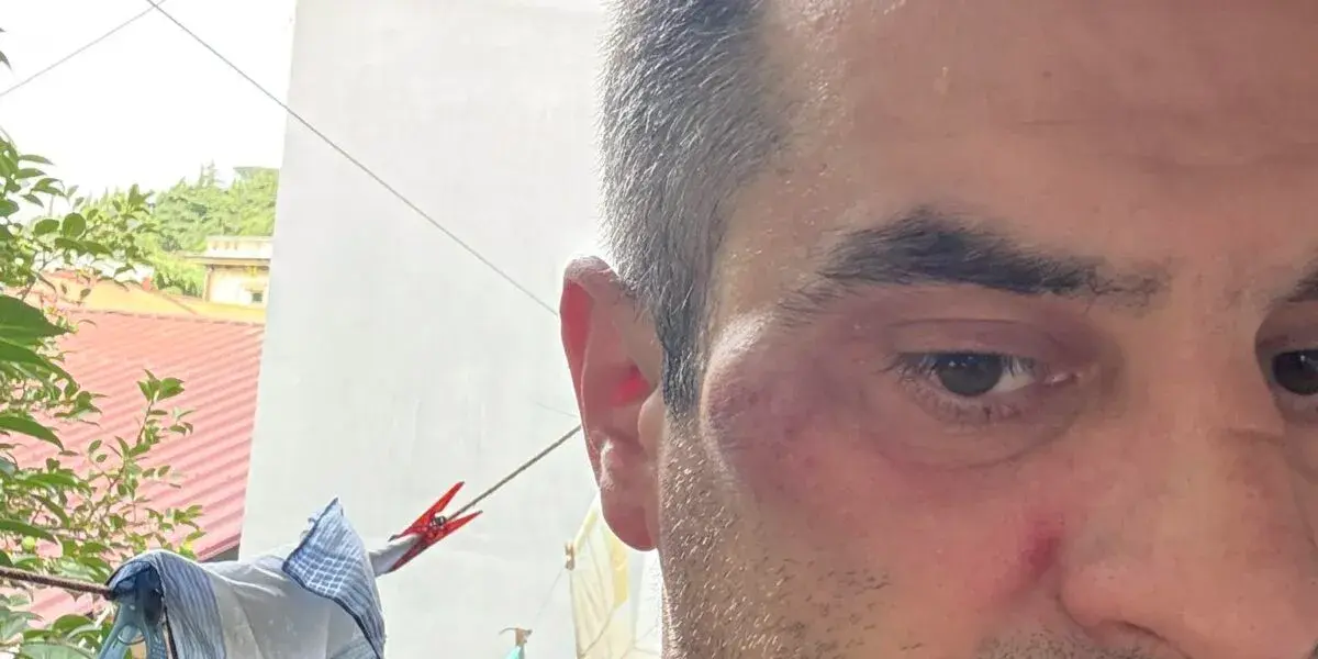На певца и актера Ванико Тархнишвили совершено нападение