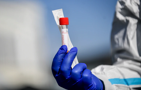 გაბუნია განმარტავს, „ბიოზეკის“ ტესტებთან დაკავშირებით  ხელშეკრულება რატომ შეწყდა