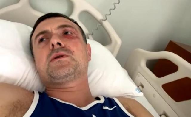 პროკურორი: ოპოზიციონერ პოლიტიკოსზე თავდამსხმელები ქვეყნის დატოვებას ცდილობდნენ