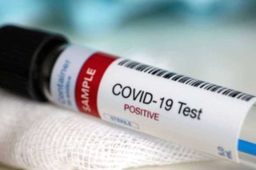 სომხეთში COVID-19–ით ინფიცირების რეკორდული დღიური მაჩვენებელი დაფიქსირდა