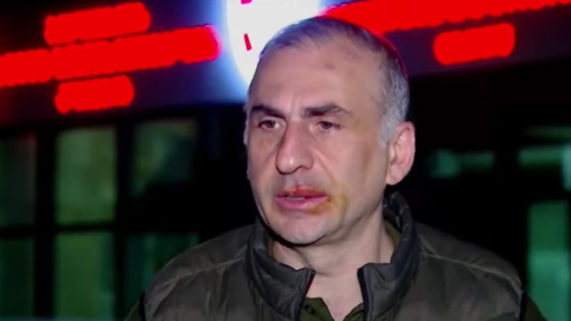 Элисашвили рассказал, что у него сломано ребро после задержания полицейскими