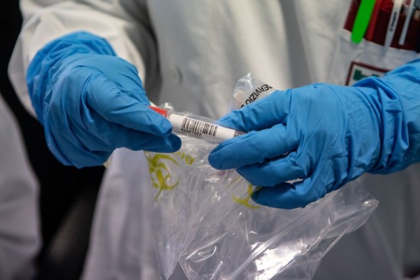 Coronavirus: 399 people infected in Georgia
