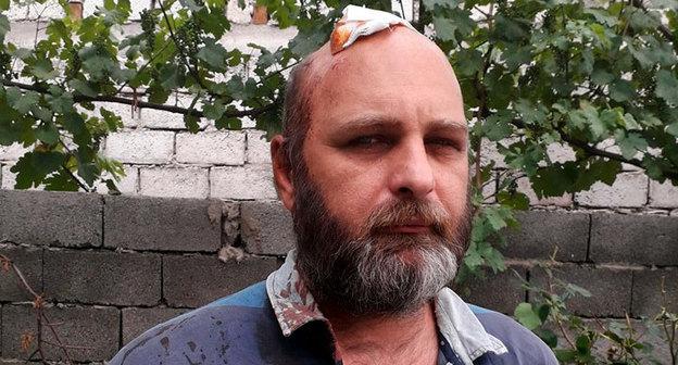 Задержанного на акции в Тбилиси журналиста вызвали в миграционную службу