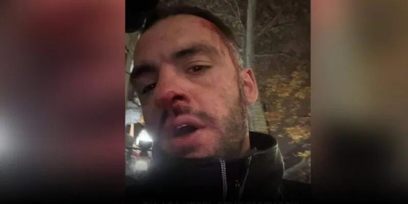 Актер Георгий Махарадзе заявил о нападении на него